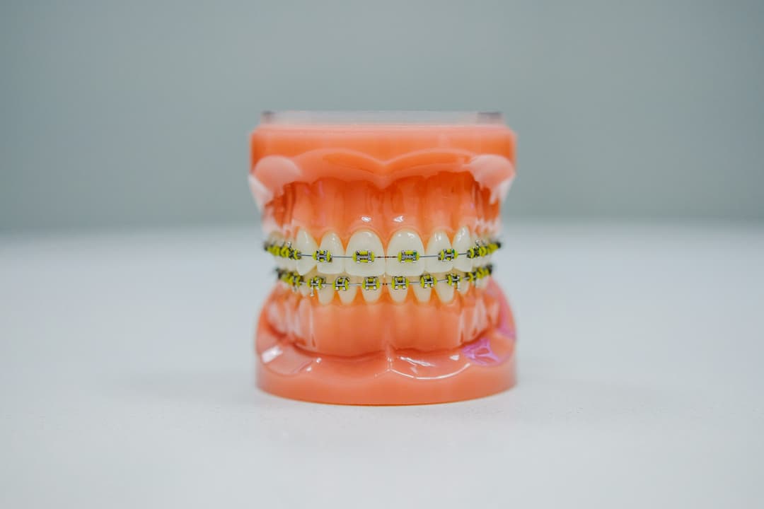 Teeth Whitening Tips for a Brighter Smile