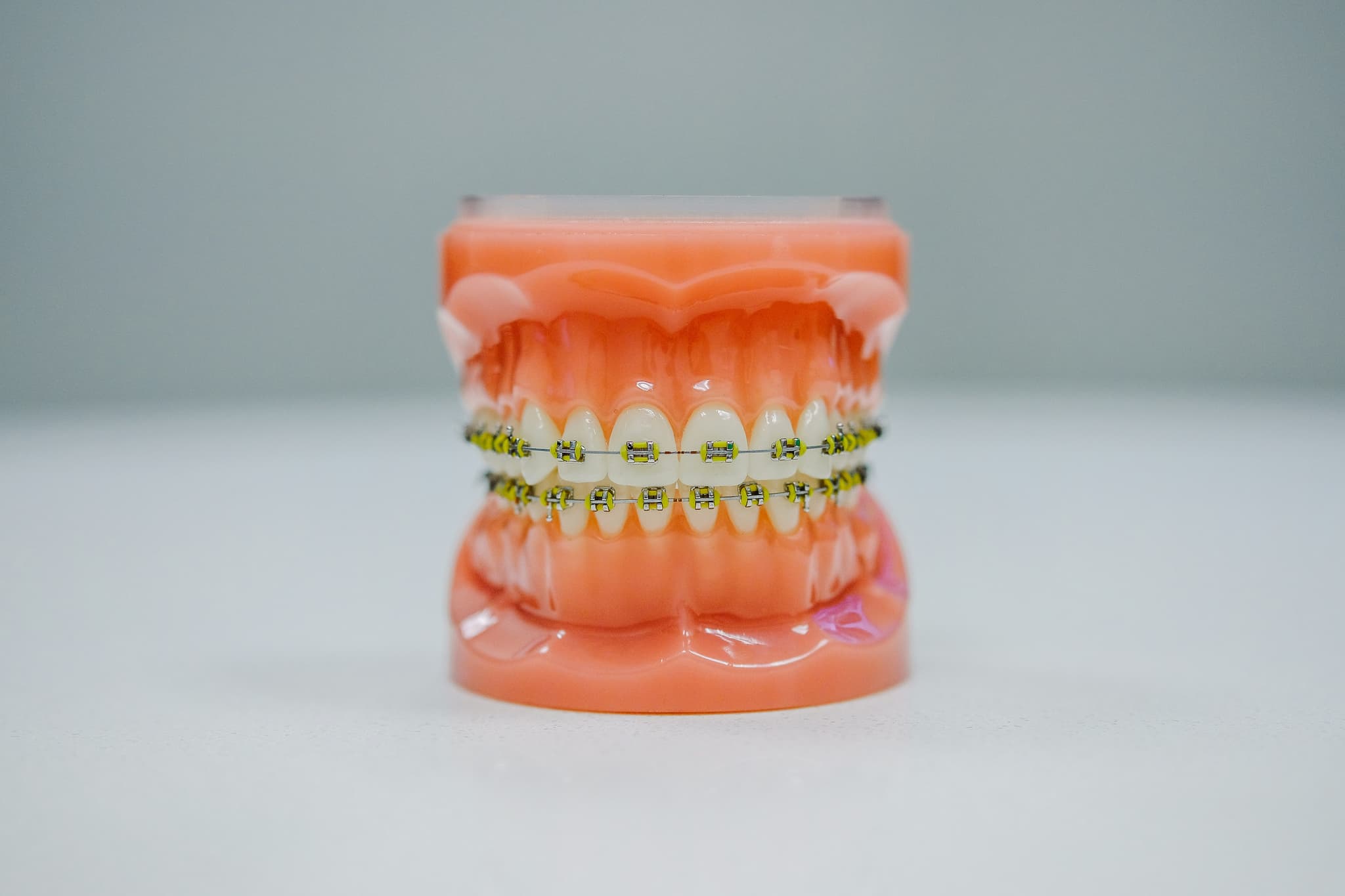 Teeth Whitening Tips for a Brighter Smile